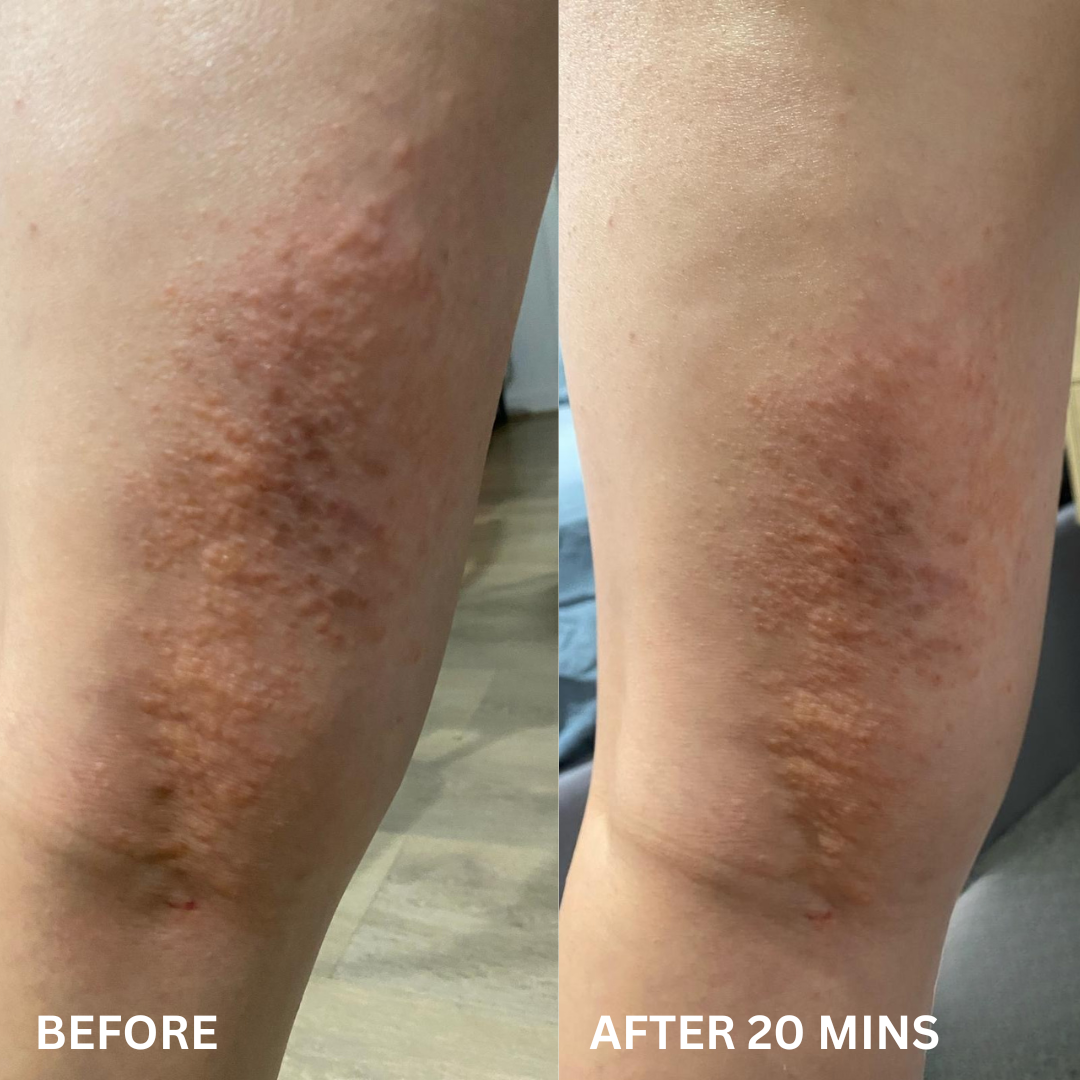 Repairing Balm for Dry & Damaged Skin