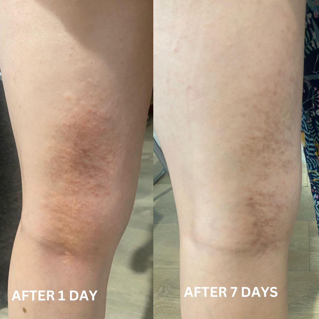 Repairing Balm for Dry & Damaged Skin