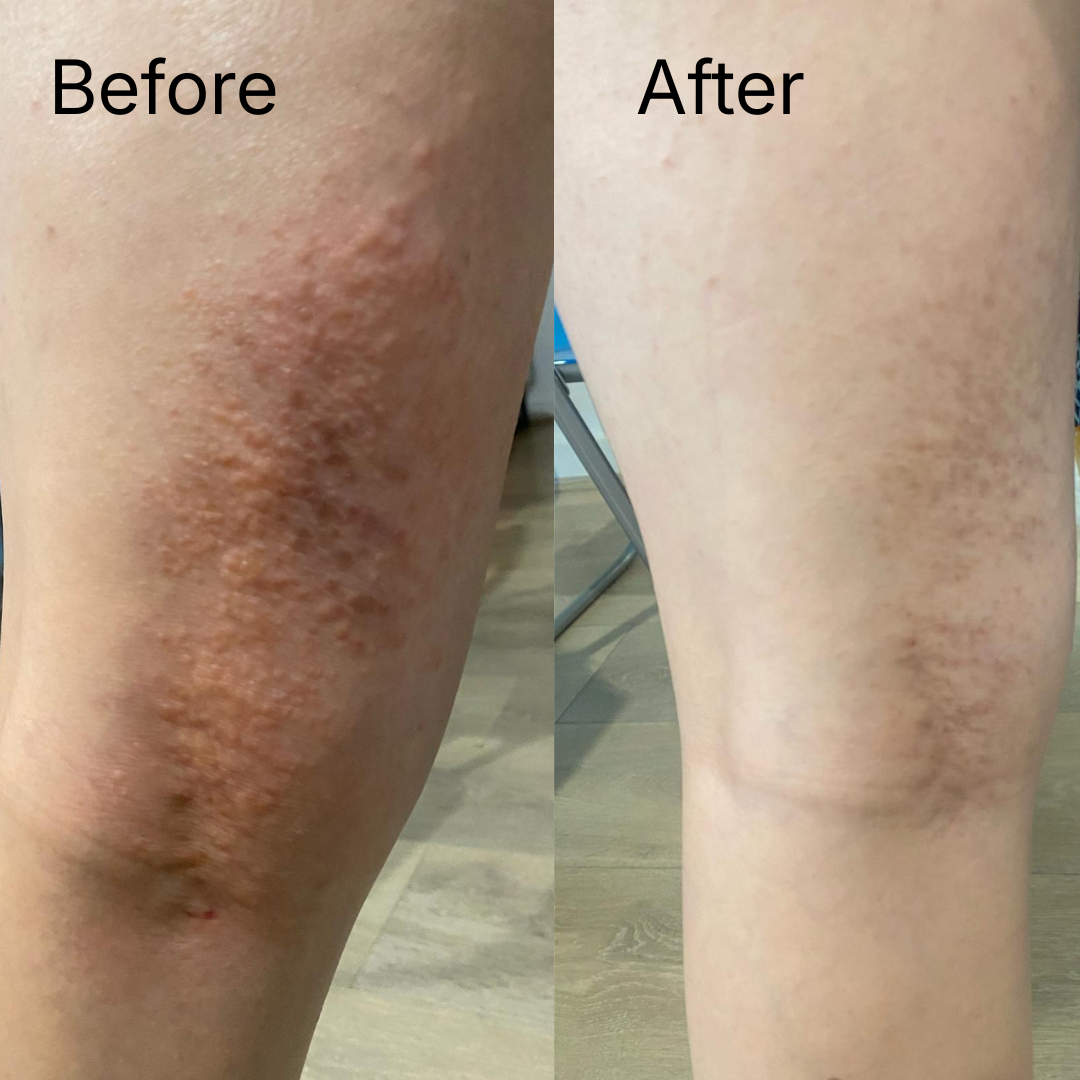 Repairing Balm - Ultra-Nourishing Barrier Balm for Sensitive Skin