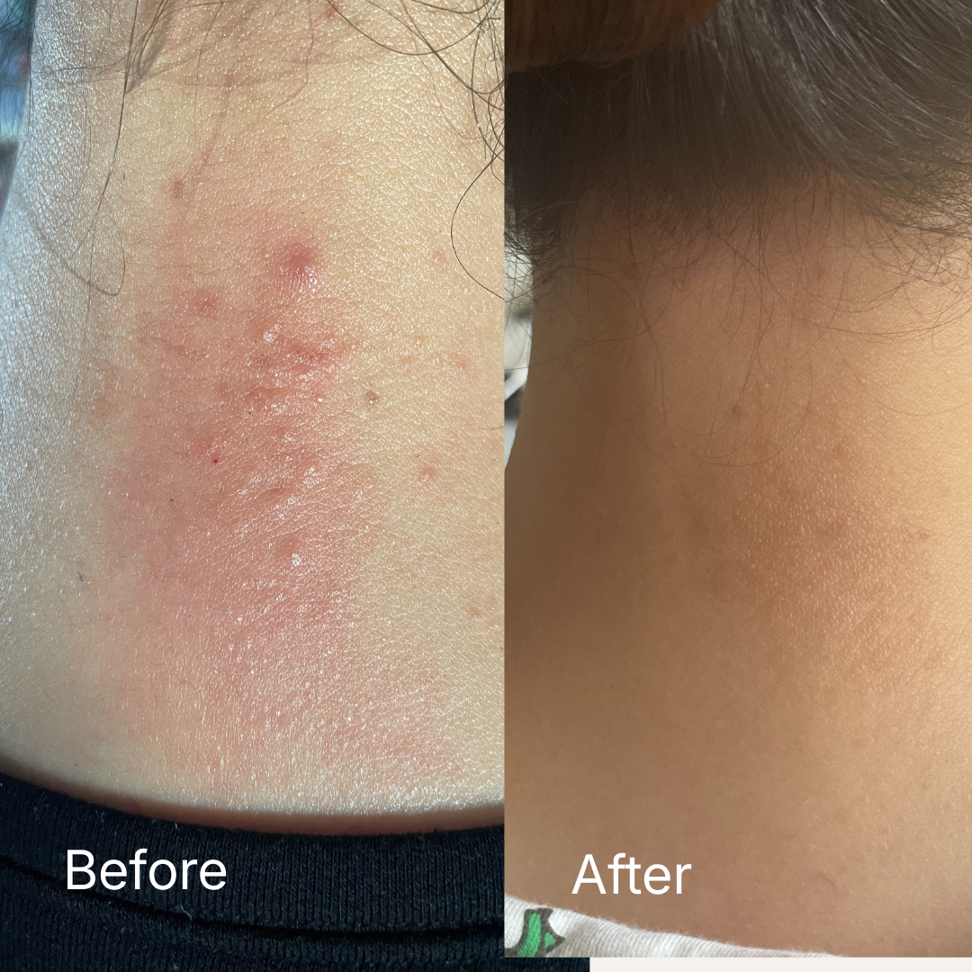 Repairing Balm - Ultra-Nourishing Barrier Balm for Sensitive Skin