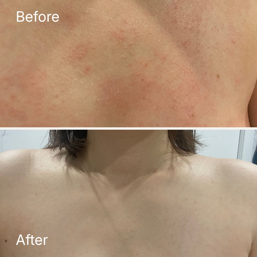 Repairing Balm - Ultra-Nourishing Barrier Balm for Sensitive Skin