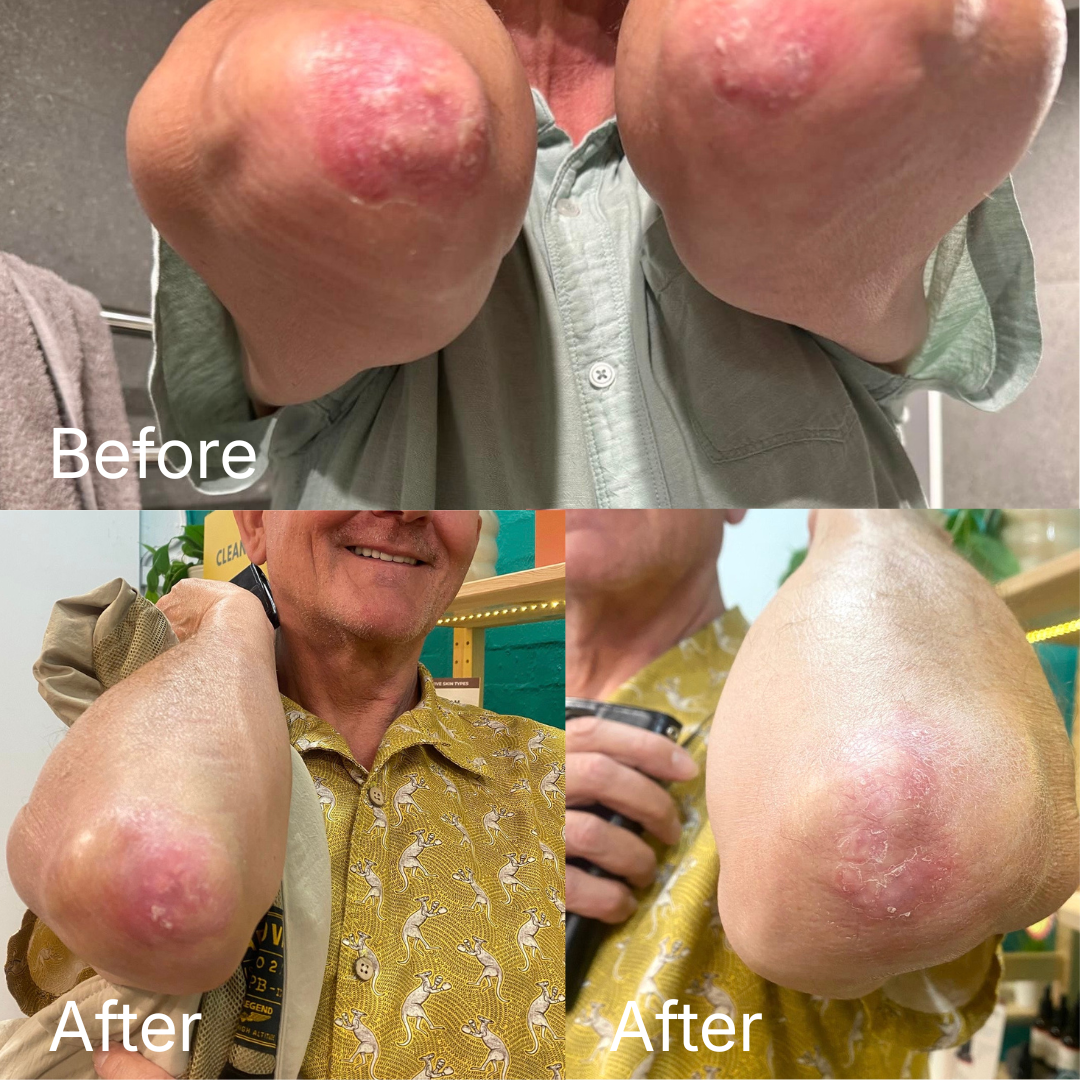 Repairing Balm - Ultra-Nourishing Barrier Balm for Sensitive Skin