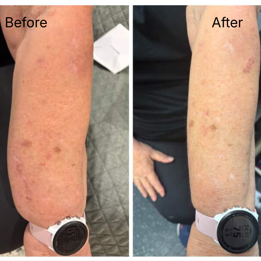 Repairing Balm - Ultra-Nourishing Barrier Balm for Sensitive Skin