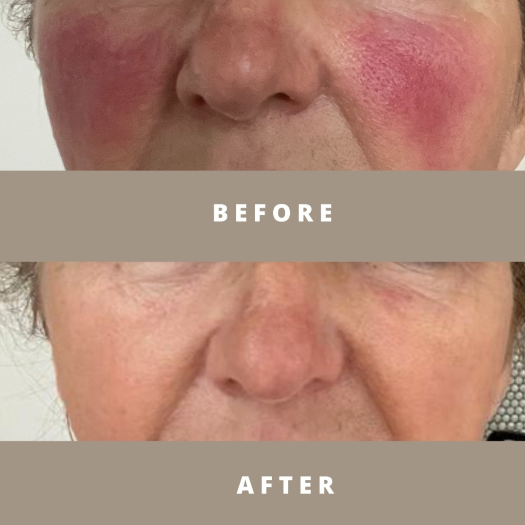 Ginseng Pearl Intense Renewal Face Cream