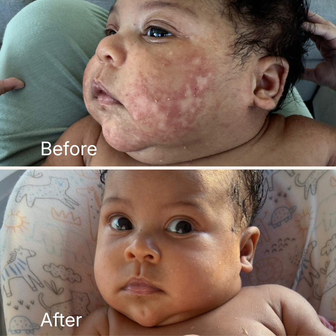 Repairing Balm - Ultra-Nourishing Barrier Balm for Sensitive Skin