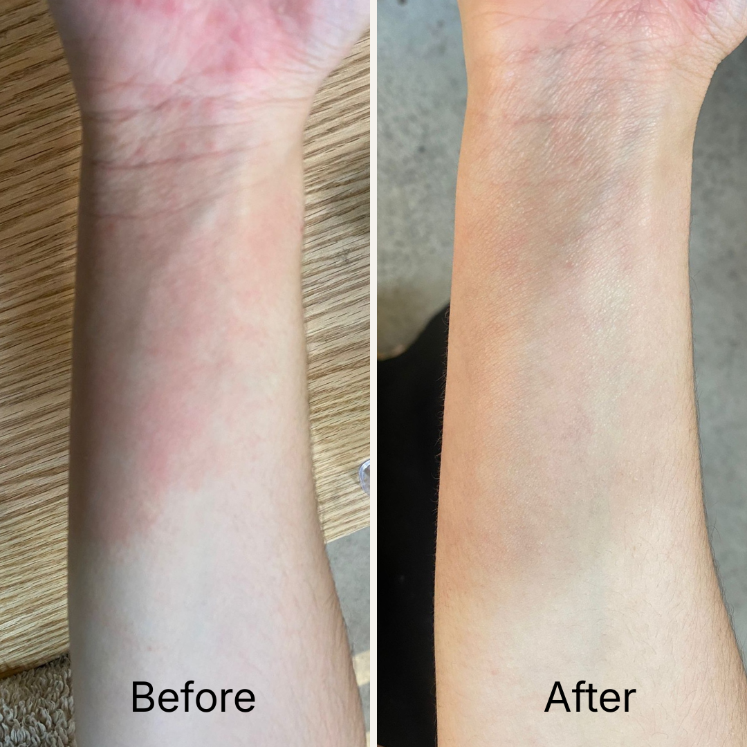 Repairing Balm - Ultra-Nourishing Barrier Balm for Sensitive Skin